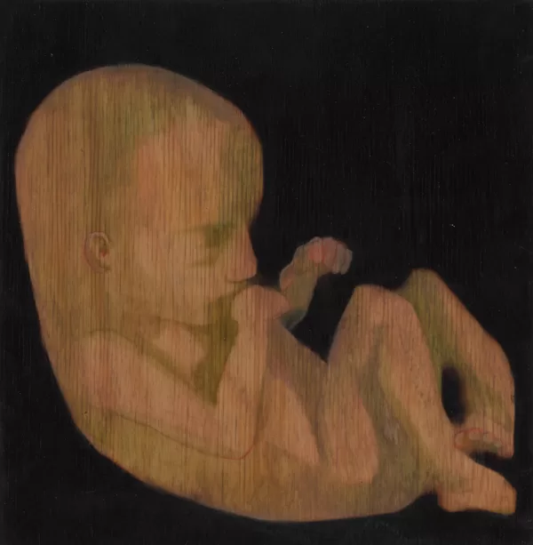  fetus/neonatus 5/11, 21x21cm, koks/eļļa